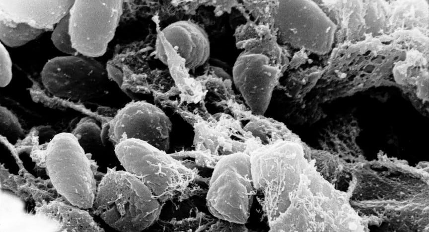 Scanning electron micrograph depicting Yersinia pestis bacteria (the cause of bubonic plague). Public Domain