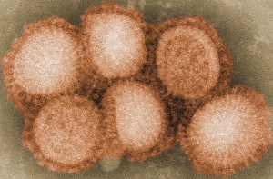 H1N1 virus by Cybercobra on Wikipedia