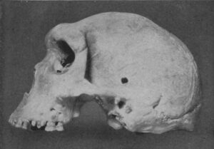 Side view of Kabwe 1, the type specimen of Homo rhodesiensis (original, approx. 300,000 years old)