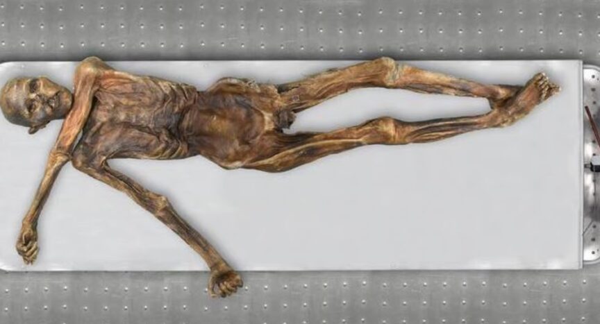 Mummified remains of Iceman Otzi reclined on a white table.